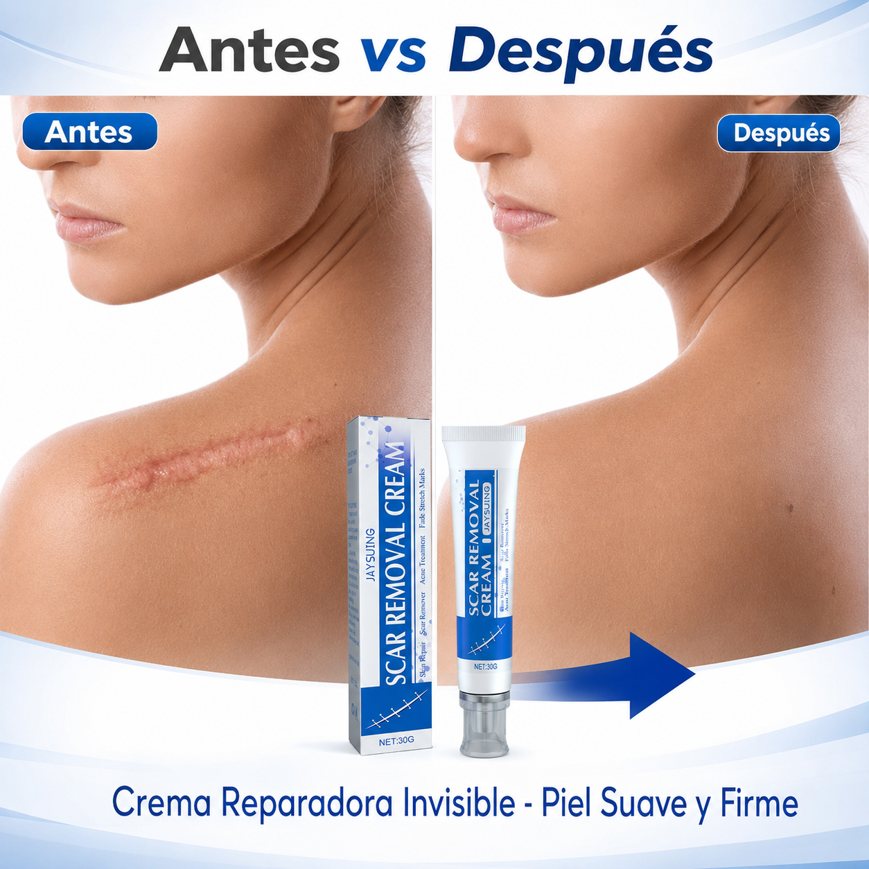 Crema Reparadora para Cicatrices - Piel Suave y Firme