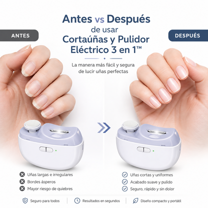 Cortaúñas y Pulidor Eléctrico 3 en 1™ Uñas perfectas en segundos
