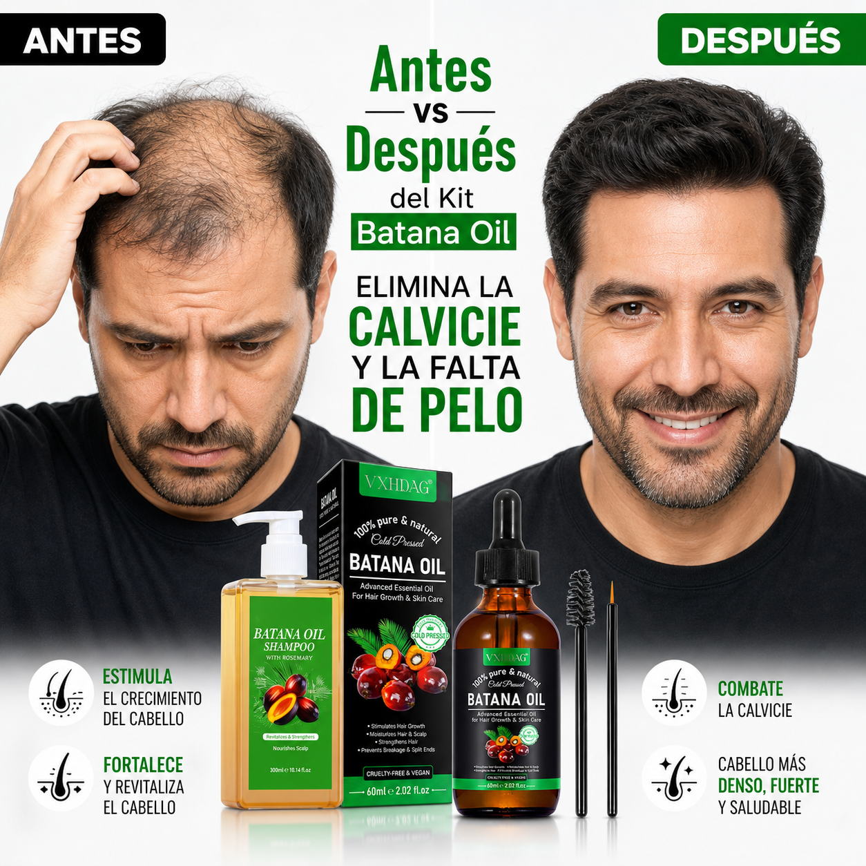 Batana Oil 2x1: Adiós Calvicie – Cabello Denso y Fuerte en semanas
