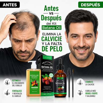 Batana Oil 2x1: Adiós Calvicie – Cabello Denso y Fuerte en semanas