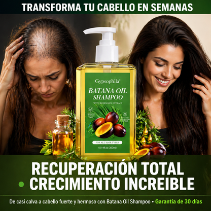 Batana Oil Shampoo: De Casi Calva a Melena Espectacular en Semanas