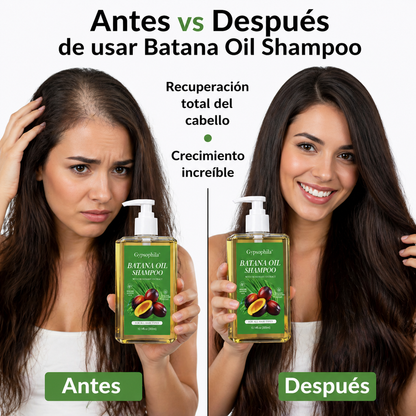 Batana Oil Shampoo: De Casi Calva a Melena Espectacular en Semanas