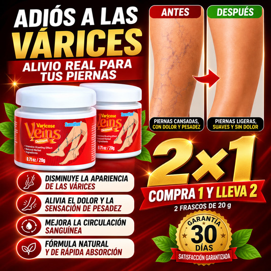 Varicose Veins | Crema para Piernas Cansadas y Pesadas