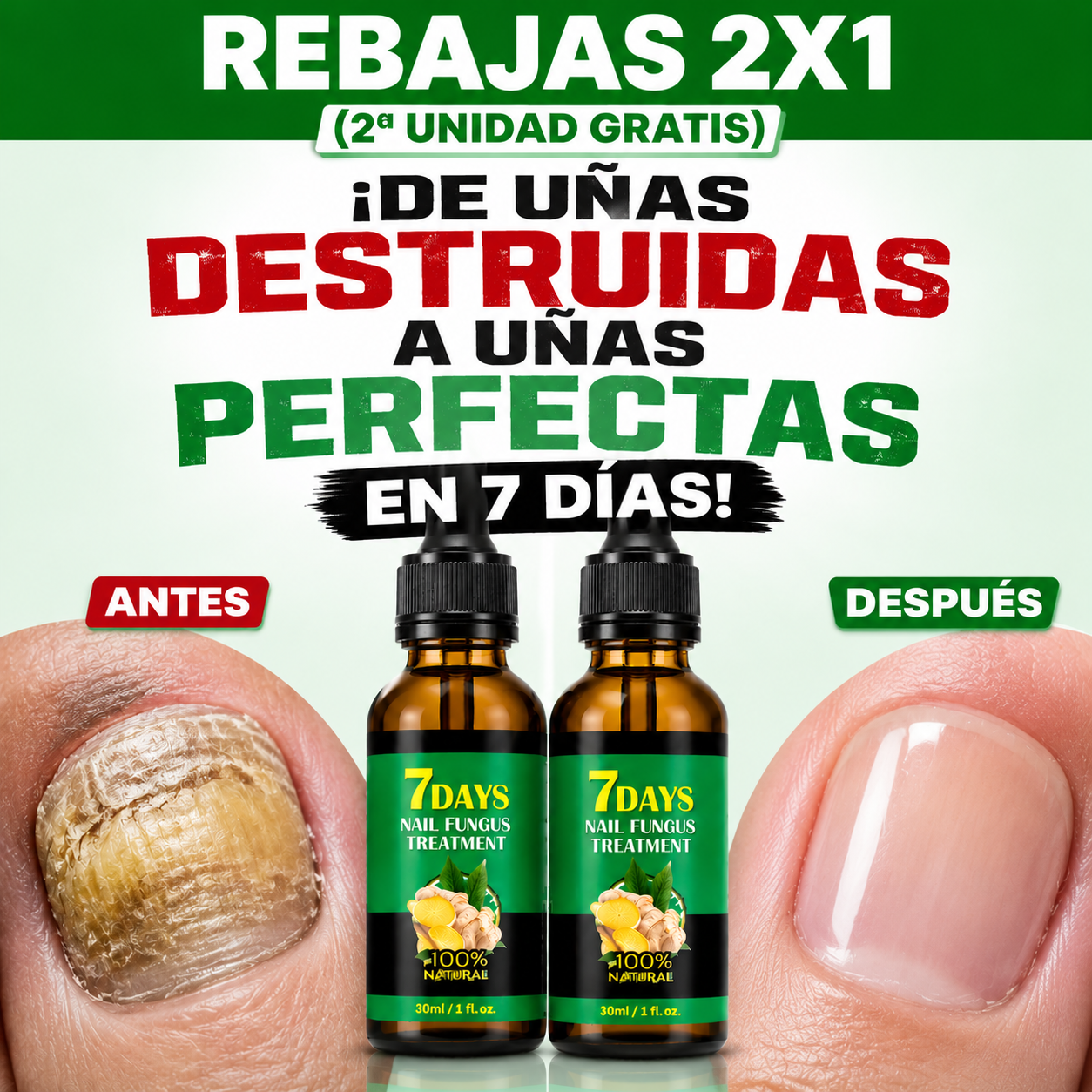 7DAYS™ - Elimina Hongos en las Uñas en Solo 7 Días