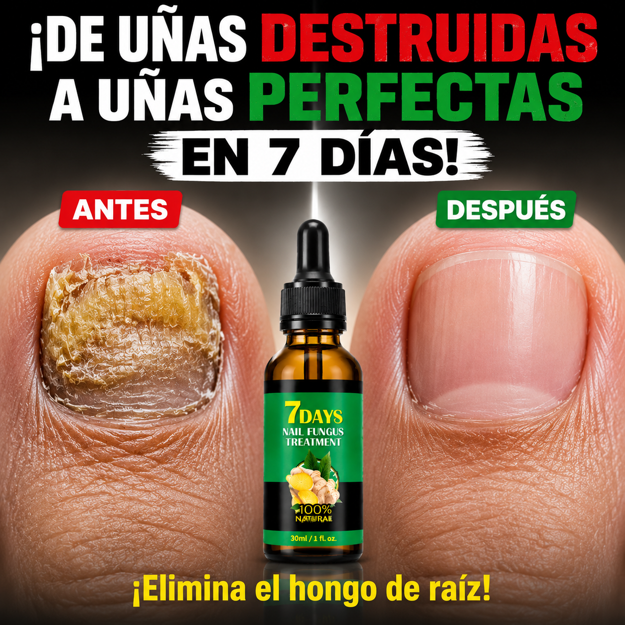 7DAYS™ - Elimina Hongos en las Uñas en Solo 7 Días