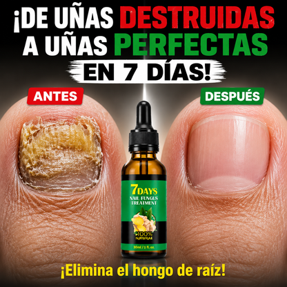 7DAYS™ - Elimina Hongos en las Uñas en Solo 7 Días