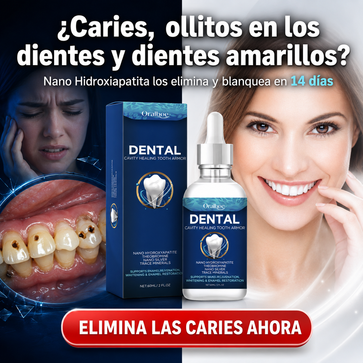 Nano Hidroxiapatita Elimina Caries, Ollitos y Dientes Amarillos - Oralbee Dental