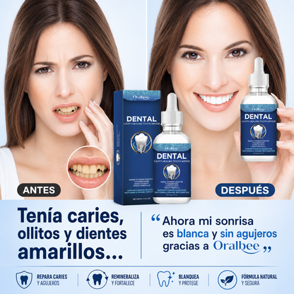 Nano Hidroxiapatita Elimina Caries, Ollitos y Dientes Amarillos - Oralbee Dental