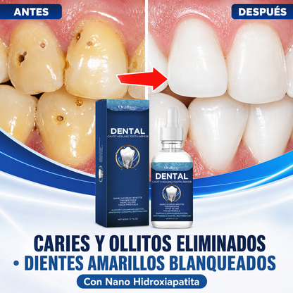 Nano Hidroxiapatita Elimina Caries, Ollitos y Dientes Amarillos - Oralbee Dental