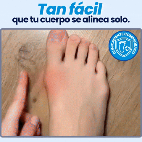 Corrector Avanzado para juanetes